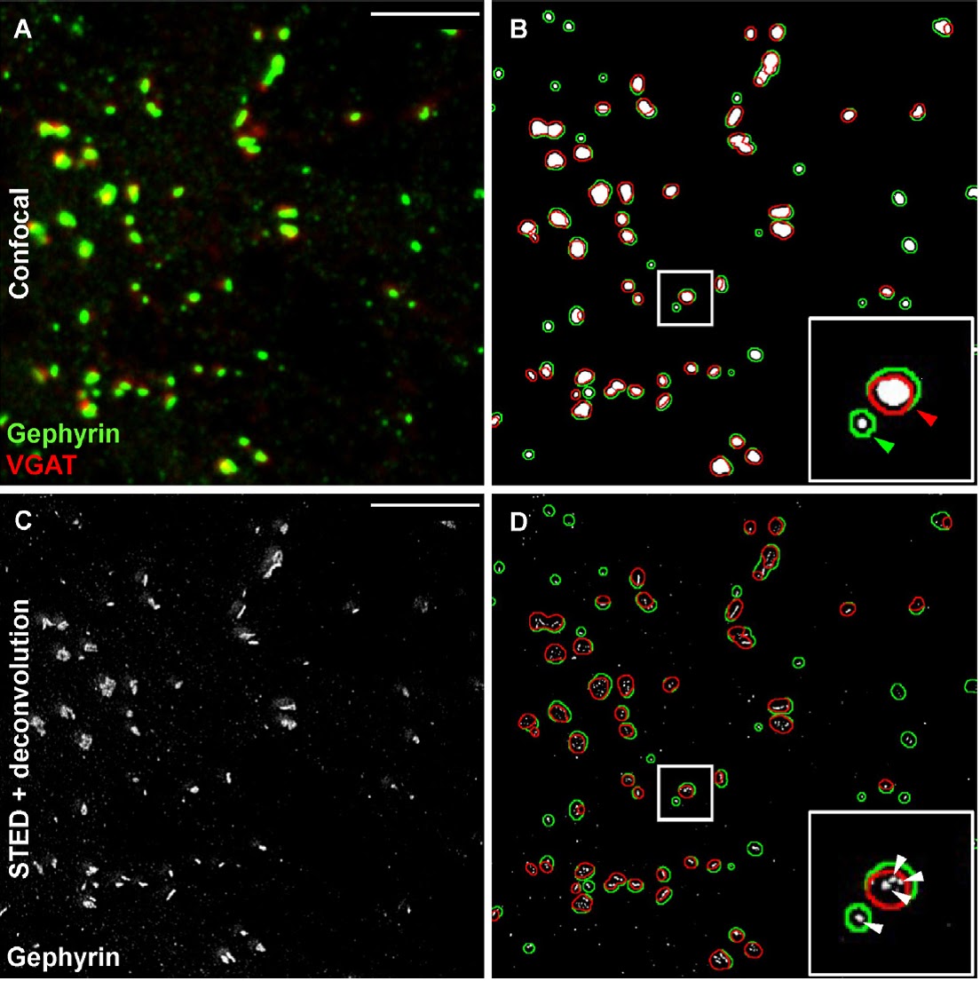 Mechanisms of neuronal plasticity NeuroScienceLab