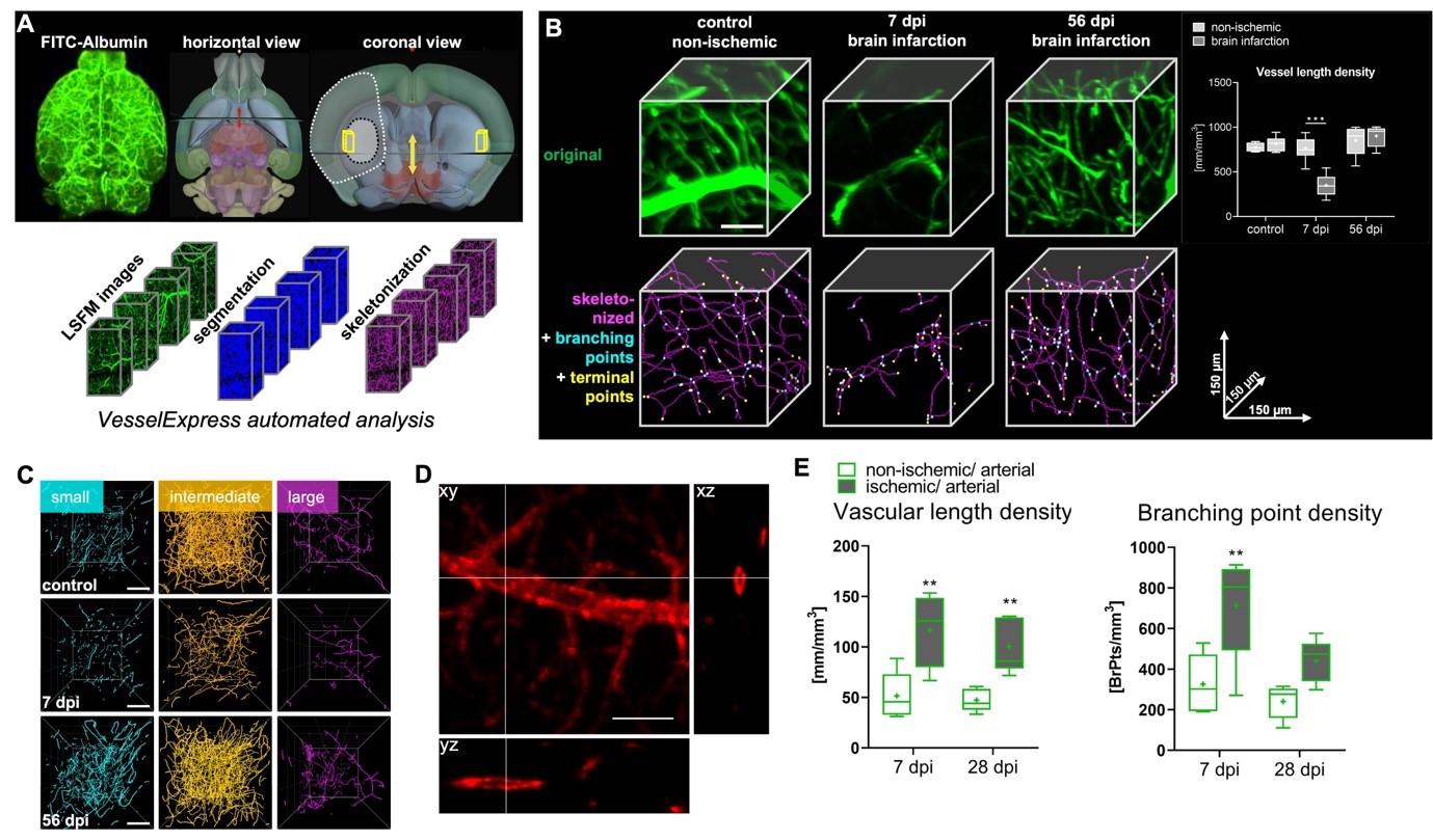 the virtual mouse brain: a computational... Analysis of microvascular network remodeling in ischemic mouse brains ...